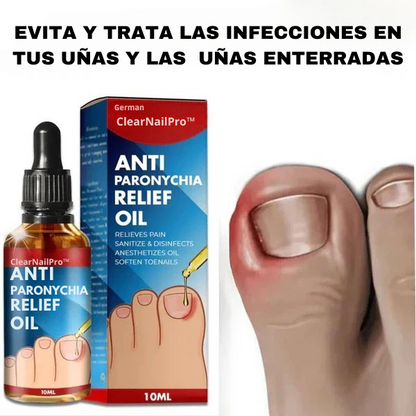 CLEARNAIL PRO ™ - Tratamiento para eliminar Hongos de uñas (Compre 1 y Reciba 2)