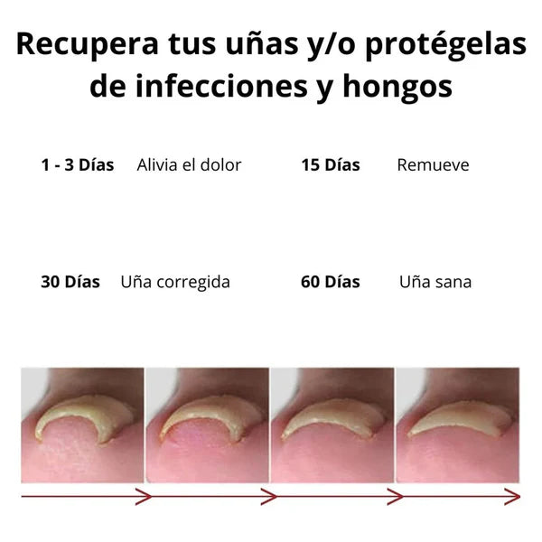 CLEARNAIL PRO ™ - Tratamiento para eliminar Hongos de uñas (Compre 1 y Reciba 2)